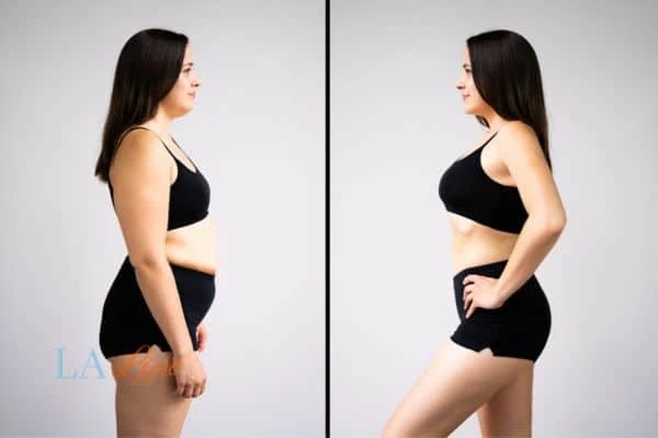 LA-EMS Body Sculpting Bury results before and after of womans results on body toning.