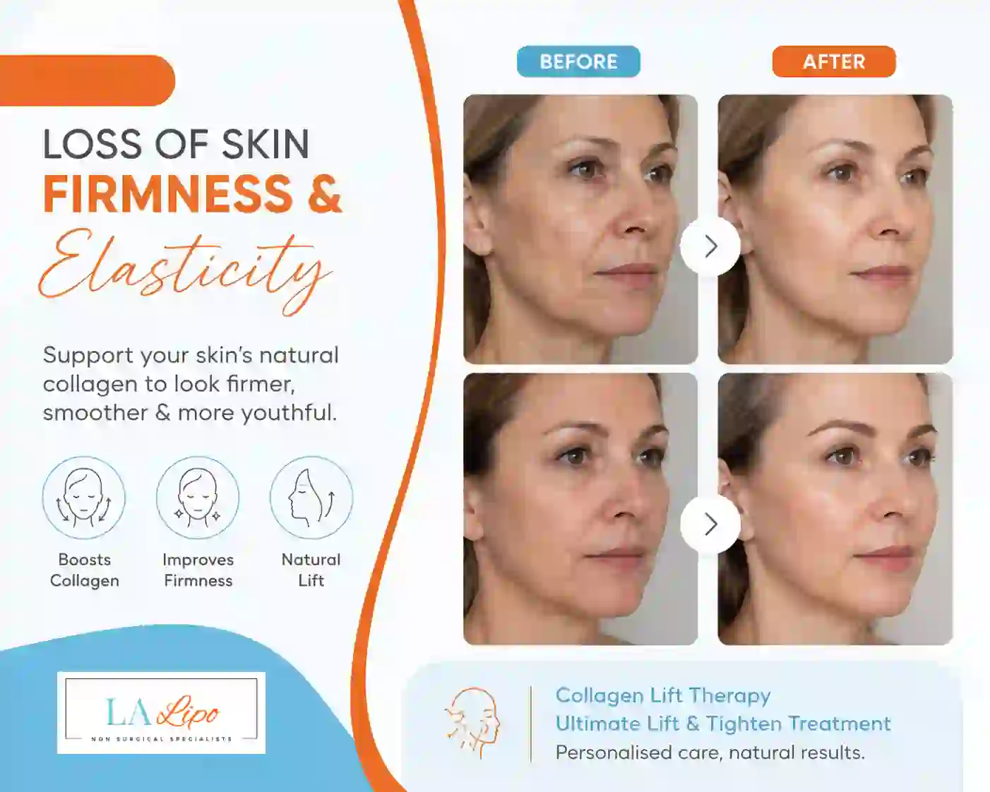 Sign #7: Loss of Skin Firmness and Elasticity Bury