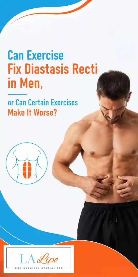 Can Exercise Fix Diastasis Recti in Men, or Can Certain Exercises Make It Worse Bury?